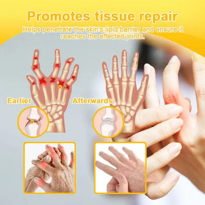 🌟👨‍⚕️🦴Official Shop:Rolimey® Bee Venom Pain Relief Bone Healing Cream 👨‍⚕️(Reduction of joint swelling, pain, stiffness, redness, heat, muscle soreness and joint fatigue)