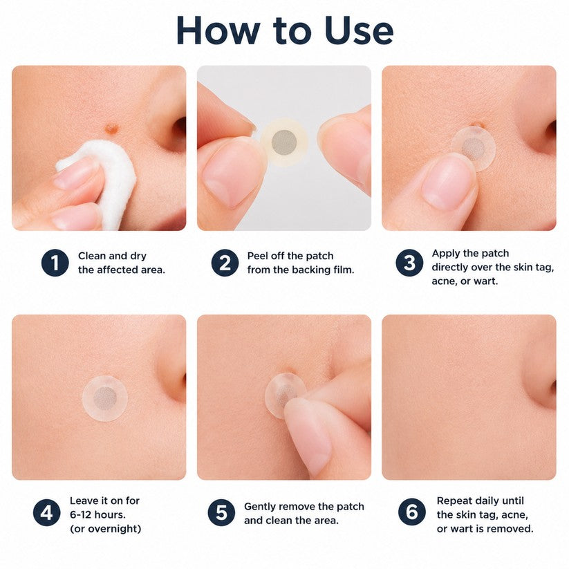GFOUK® 2-in-1 Microneedle & Hydrocolloid Patch🍀 | Removes raised moles, acne, flat warts, and skin tags | Invisible patches for face and body