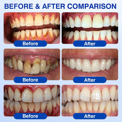 🎁🦷30 OFF FOR Evolvion® GumVital Advanced Gum Care Gel🛡️🎁