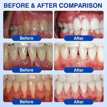 🇺🇸👩‍⚕️🦷😊Evolvion® GumRevive Periodontal Repair Gel🛡️✨
