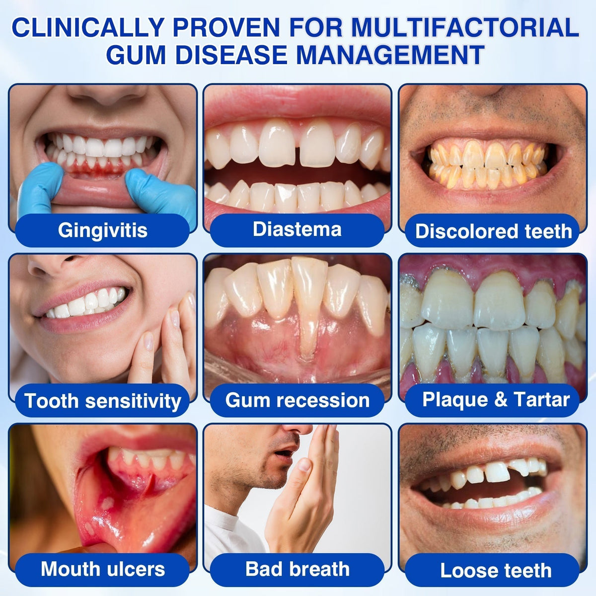 🇺🇸👩‍⚕️🦷😊Evolvion® GumRevive Periodontal Repair Gel🛡️✨