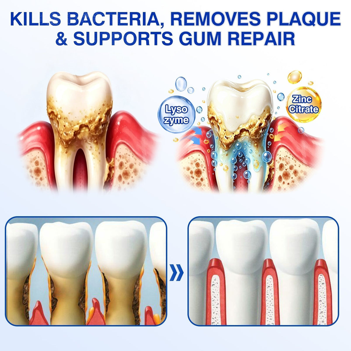 🇺🇸👩‍⚕️🦷😊Evolvion® GumRevive Periodontal Repair Gel🛡️✨