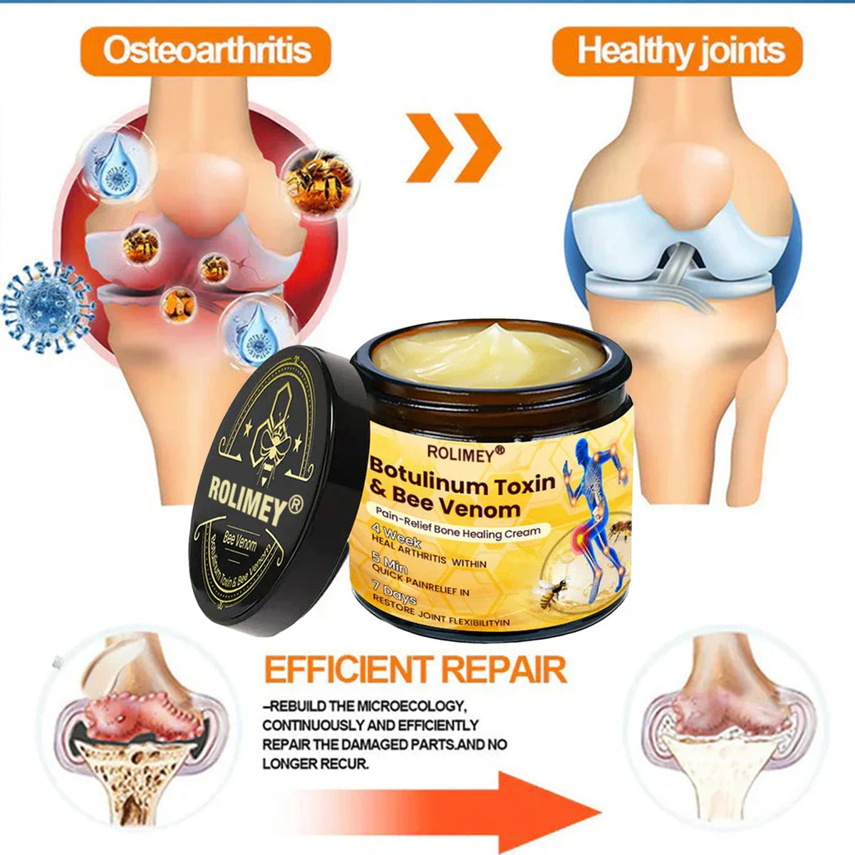 🎄🎁 Early Christmas Special|🌟Official Shop:Rolimey® Bee Venom Pain Relief Bone Healing Cream 👨‍⚕️(Reduction of joint swelling, pain, stiffness, redness, heat, muscle soreness and joint fatigue)
