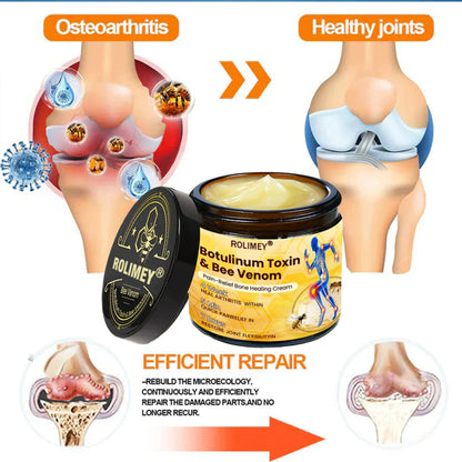 🎄🎁 Early Christmas Special|🌟Official Shop:Rolimey® Bee Venom Pain Relief Bone Healing Cream 👨‍⚕️(Reduction of joint swelling, pain, stiffness, redness, heat, muscle soreness and joint fatigue)