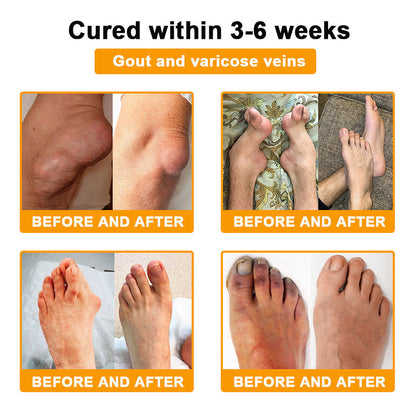 🌟👨‍⚕️🦴Official Shop:Rolimey® Bee Venom Pain Relief Bone Healing Cream 👨‍⚕️(Reduction of joint swelling, pain, stiffness, redness, heat, muscle soreness and joint fatigue)