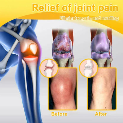 🎁👨‍⚕️Official Shop:Rolimey® Bee Venom Pain Relief Bone Healing Cream 👨‍⚕️(Reduction of joint swelling, pain, stiffness, redness, heat, muscle soreness and joint fatigue)