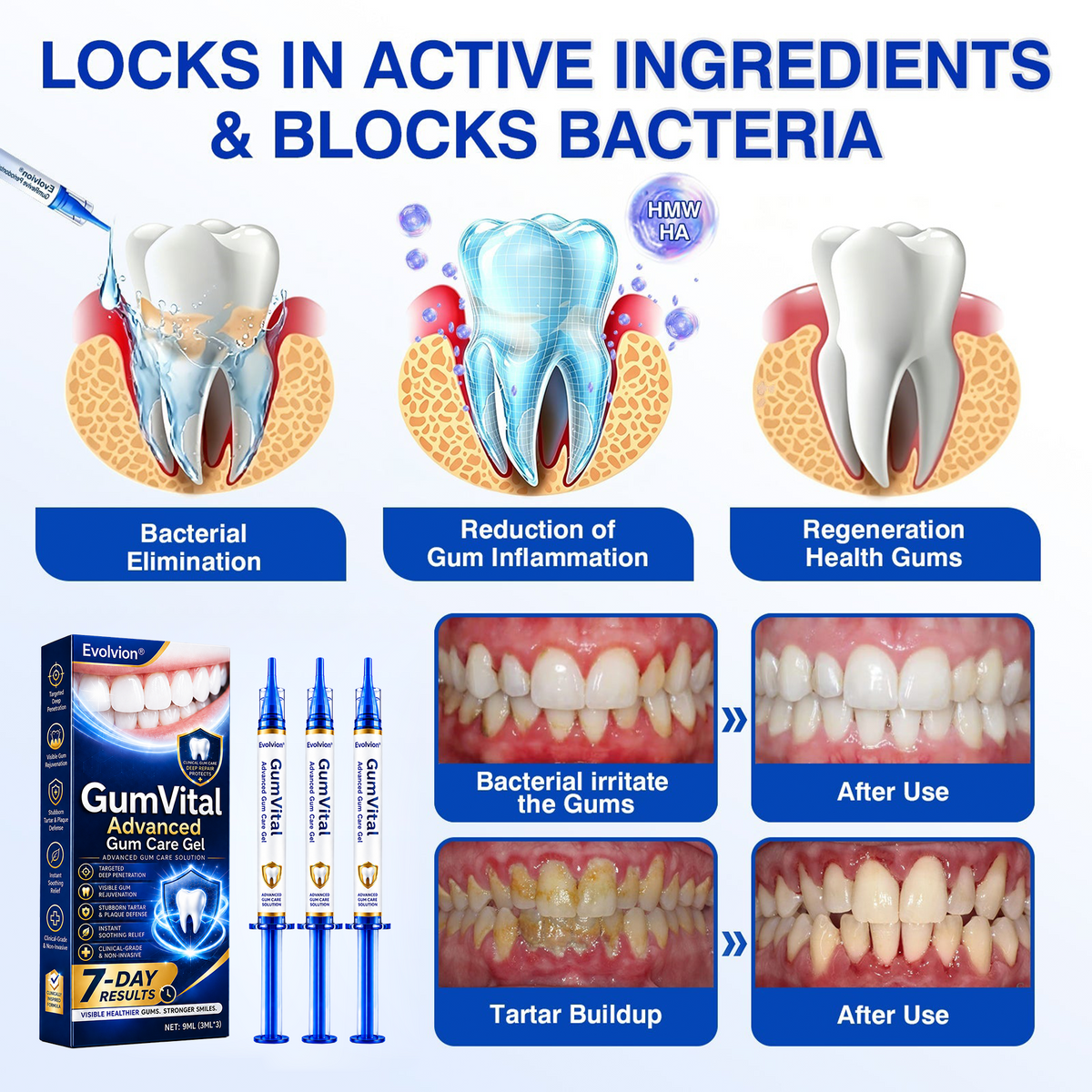 🇺🇸👩‍⚕️🦷😊Evolvion® GumRevive Periodontal Repair Gel🛡️✨