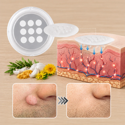 GFOUK® 2-in-1 Microneedle & Hydrocolloid Patch🍀 | Removes raised moles, acne, flat warts, and skin tags | Invisible patches for face and body